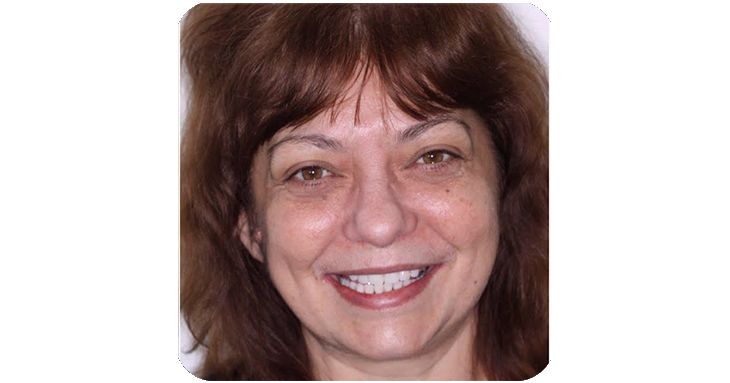 ProDentim customer testimonial